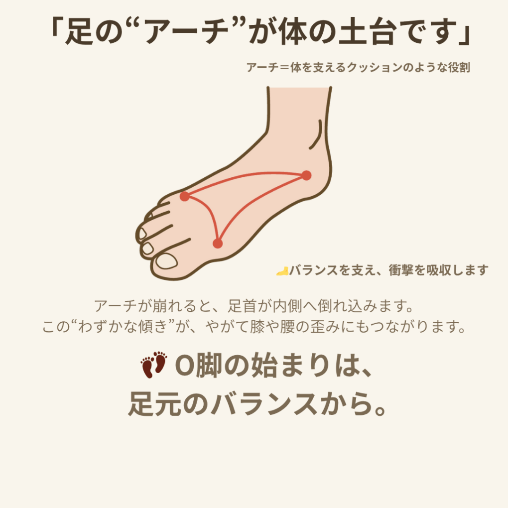 足のアーチが体の土台として重要であることを説明するイラスト。アーチが崩れると足首が内側へ倒れ込む様子を示した図。